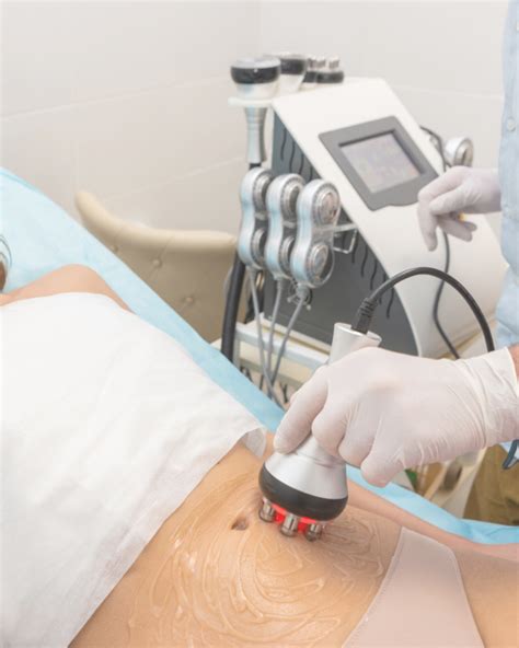 velashape valencia|Medicina Estética Corporal en Valencia .